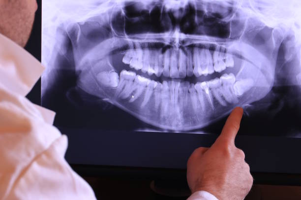 Best Emergency Care for Gum Disease in Lake Panasoffkee, FL